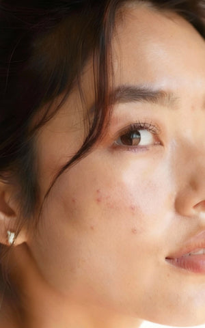 À imperfections